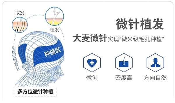 大麦微针加密植发价格