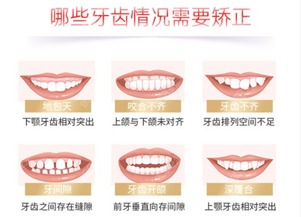 深圳宝城口腔医院牙齿矫正价格表