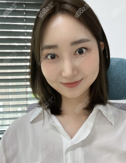 这是术后3个月双眼皮修复和隆鼻恢复图