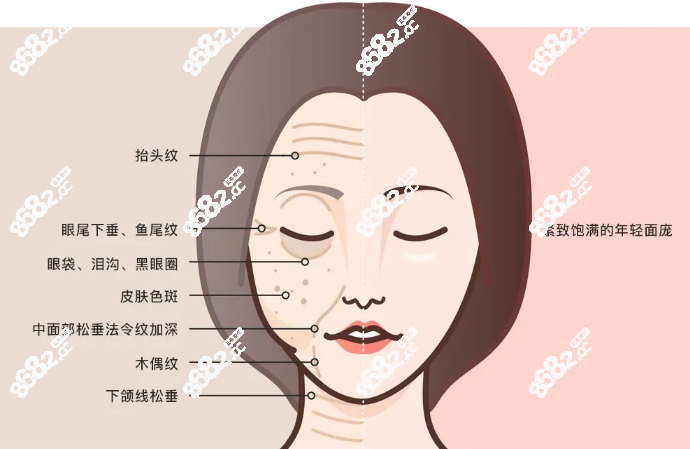 王驰拉皮手术如何收费