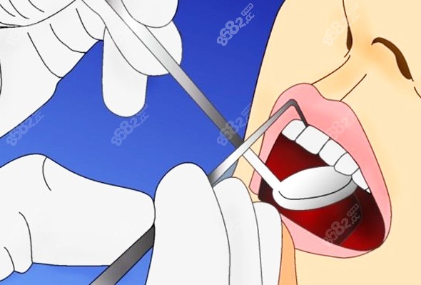 关于镶牙的注意事项