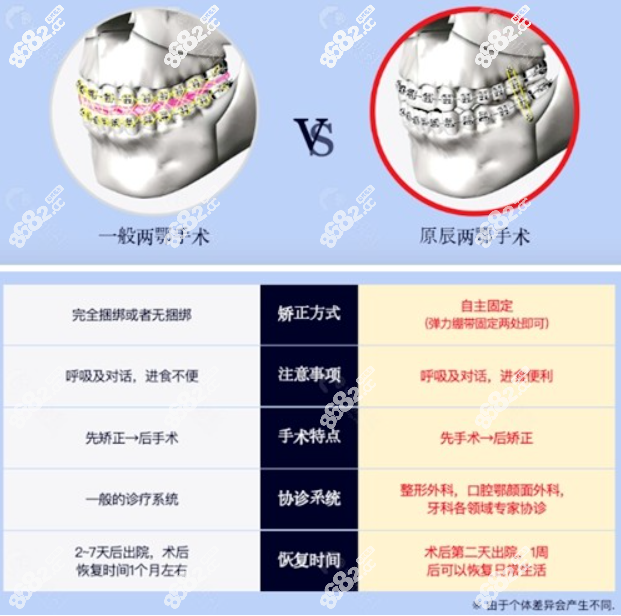 韩国原辰自主捆绑双鄂整形技术优势