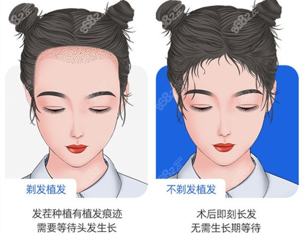 合肥<!--<i data=20240705-sp></i>-->植发价格