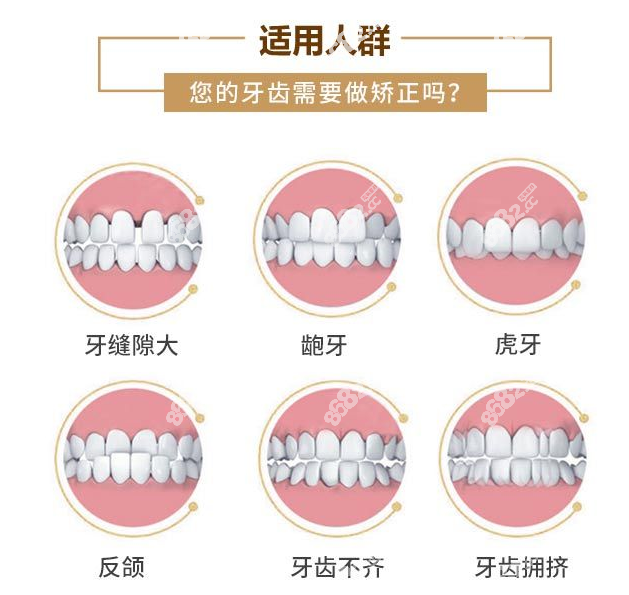 兰州牙齿矫正一般多少钱