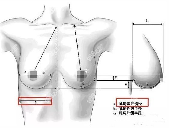 黄名斗和沈正宇做隆胸谁好