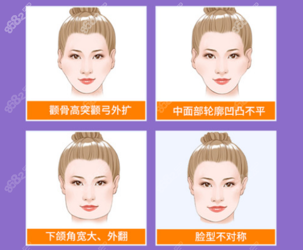 杭州瑞丽整形医院磨骨价格表
