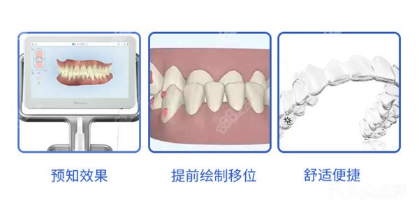 <!--<i data=20240705-sp></i>-->金典口腔矫正优势