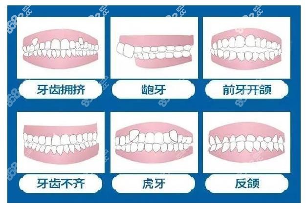 丽水牙齿矫正价格表