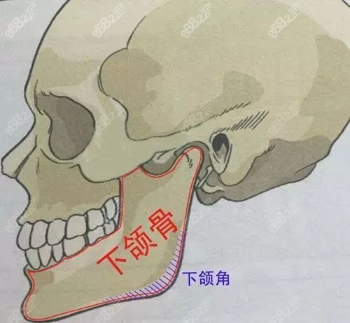 新疆黎美磨骨手术优势