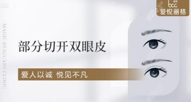 <!--<i data=20240705-sp></i>-->麗格雙眼皮好不好