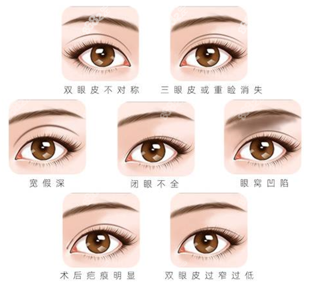 杭州时光做眼修复好的医生是范眉清和黄良飞