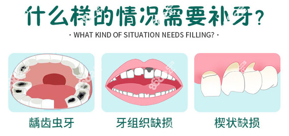 兰州补牙去哪个医院好