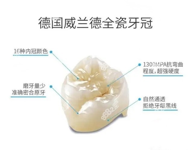 朔州做威兰德全瓷牙的价格不贵