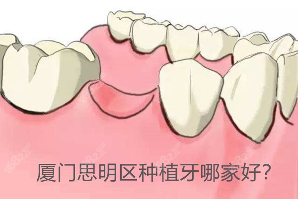 <!--<i data=20240705-sp></i>-->区种植牙哪家好