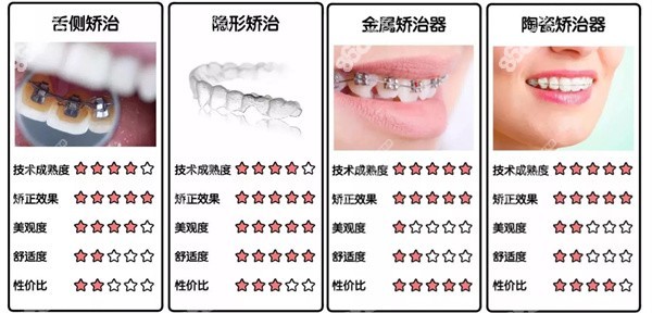 金属矫正、隐形矫正、舌侧矫正等对比