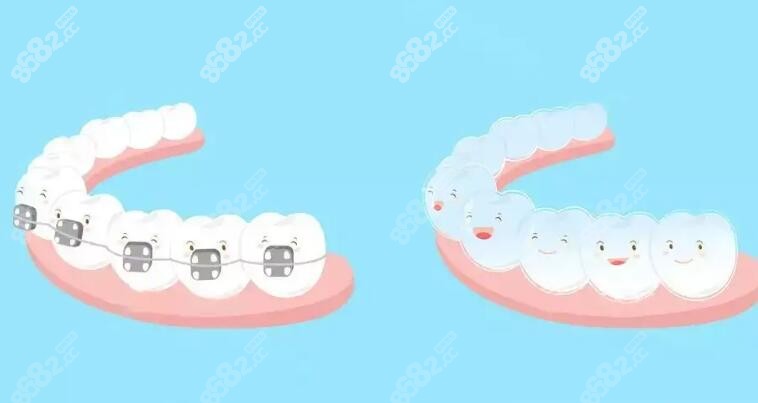 牙齿矫正卡通图