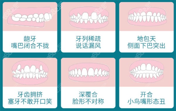 余姚牙齿矫正多少钱