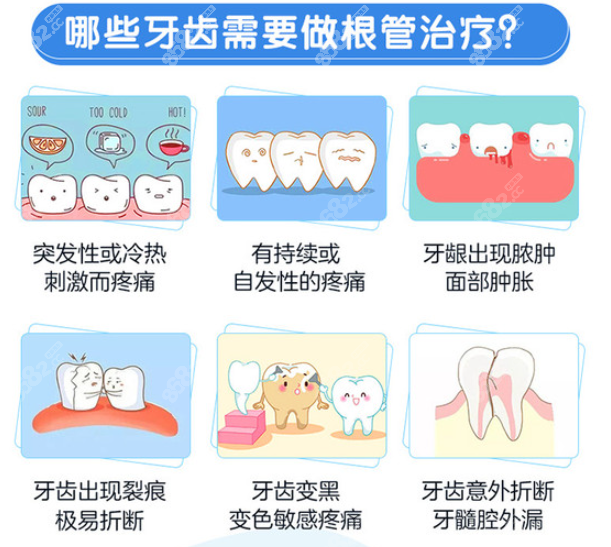 兰州德尔牙科常做的根管治疗类型