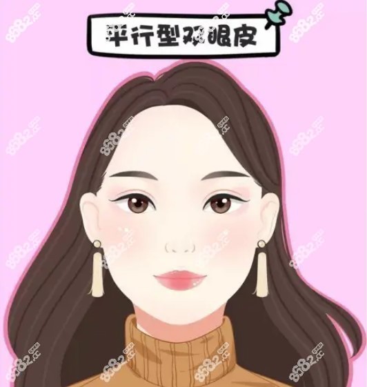 广州美莱田跃平做的双眼皮肉条消除手术恢复三个月图片