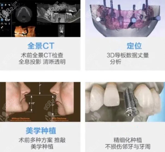 福州同福医口腔数字化种植牙技术优势