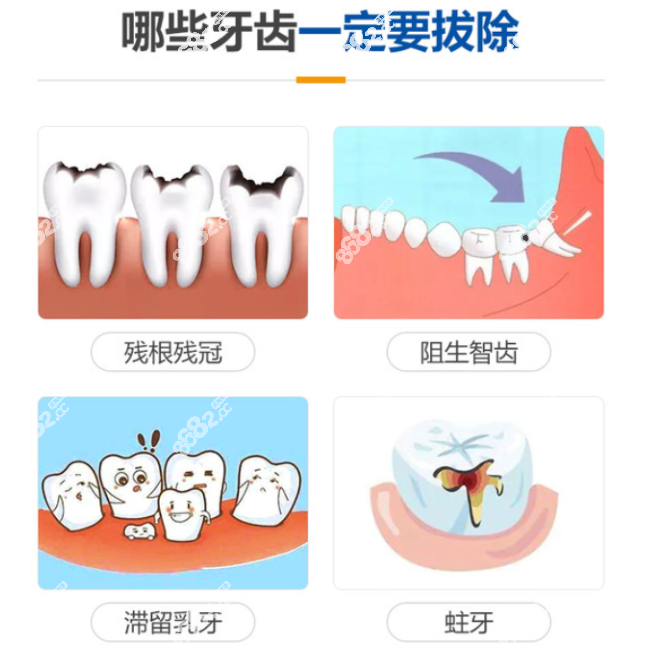 梧州拔智齿去哪家医院好