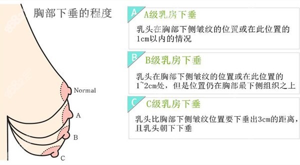 做胸部垂吊手术时可以同时做胸部脂肪填充