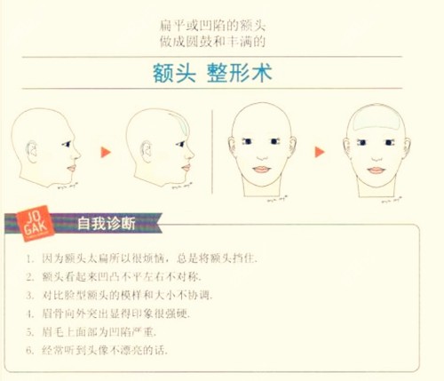 韩国雕刻额头填充技术优势