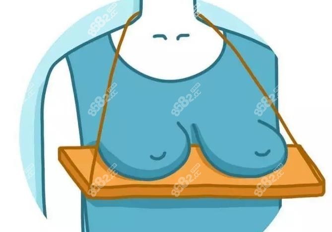 乳房悬吊术和假体隆胸可以一起做