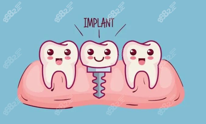种植牙卡通图