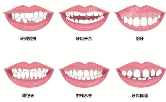 大冶中山口腔矫正牙齿多少钱