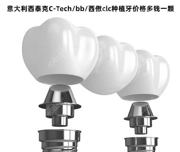 意大利西泰克C-Tech/bb/西傲clc种植牙价格多钱一颗