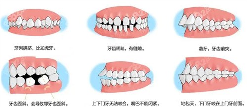 唐山正畸医生哪个好？