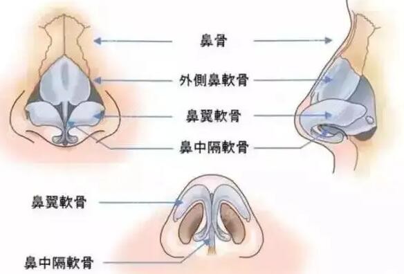隆鼻