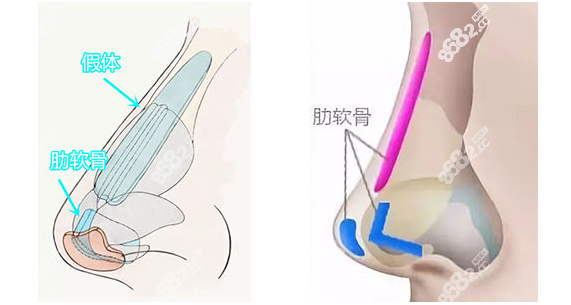 重庆铜雀台汪志强做鼻子好不好