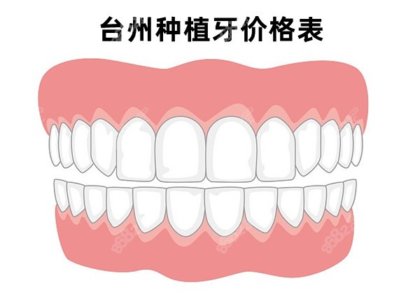 台州种植牙价格表