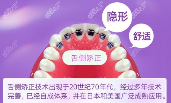 为什么舌侧隐形矫正牙齿价格贵
