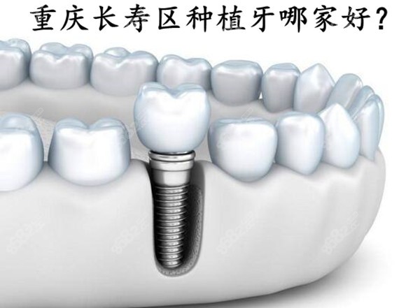 重庆长寿区种植牙哪家好