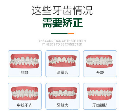 重庆九龙坡做牙齿矫正好的医院