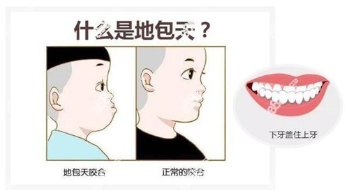 www.8682.cc提供的武汉儿童牙齿地包天矫正的医院推荐