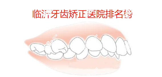 临沂牙齿矫正医院排名