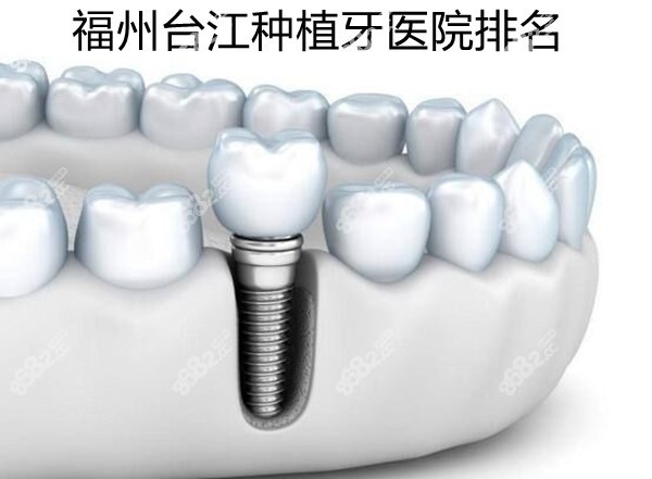 福州台江种植牙医院排名