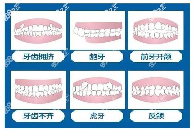 重庆解放碑附近做牙齿矫正价格一般多少钱