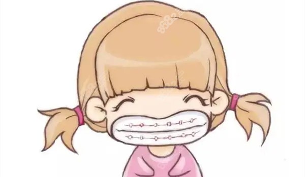武汉儿童牙齿矫正
