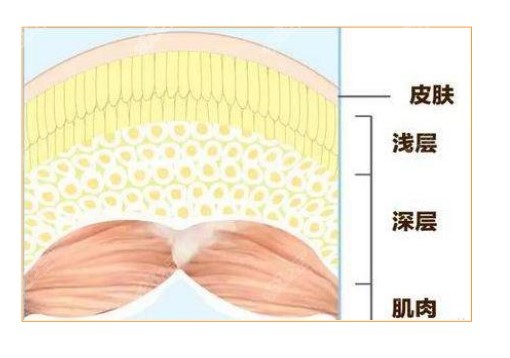 北京杨佳琦丰胸做的怎么样