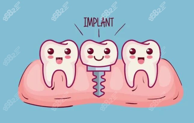 这是种植牙卡通图片