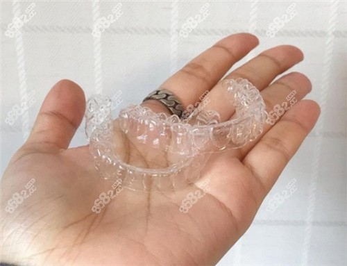 牙套图片示意图