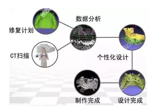 美奥口腔数字化种植技术