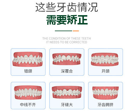 酒泉<!--<i data=20240705-sp></i>-->腔医院做牙齿矫正的类型图