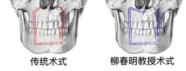 北京联合丽格整形医院凸嘴柳春明治疗优势