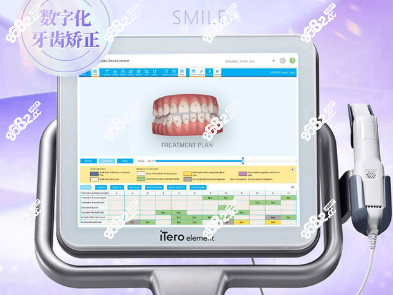 湛江牙齿矫正口扫仪器